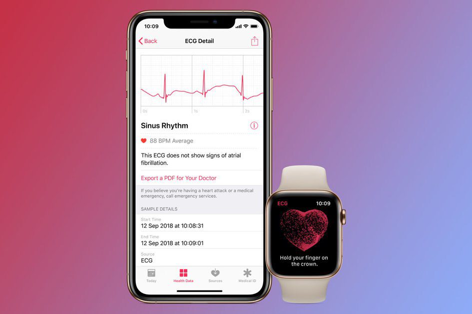 1️⃣ Apple Watch EKG: Was ist das, wie funktioniert es und wie stellen