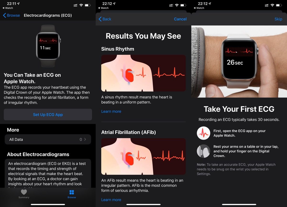 watchOS 6 Update Brings A-Fib Detection and ECG App to Apple Watch Users in India