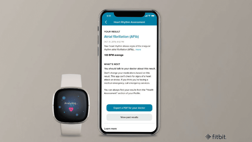 Die neue EKG-App von Fitbit Sense wird jetzt eingeführt 52